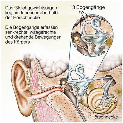 neuropathie vestibularis.